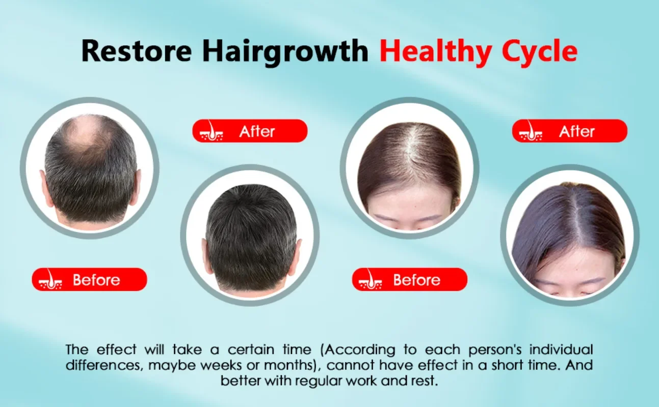 Hair Growth Cap ชาร์จ 2000mAh  - Hair Care With Protein บทวิจารณ์และราคา