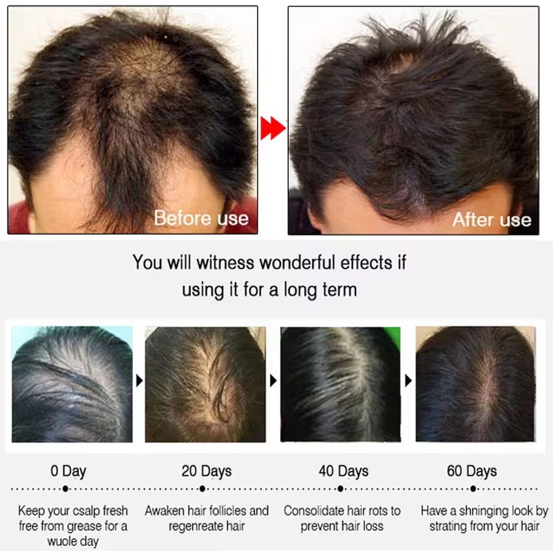 สเปรย์เร่งผมยาวขึ้นอย่างรวดเร็ - Hair Care With Protein บทวิจารณ์และราคา